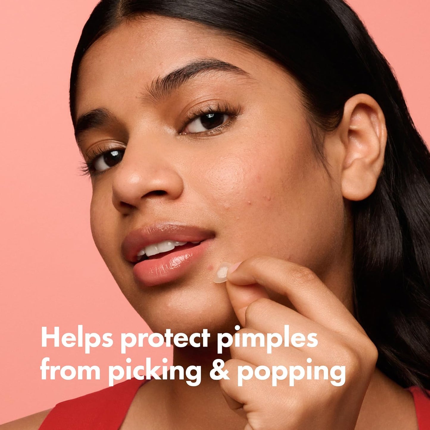 Mighty Patch Original: The Overnight Acne Solution You Need