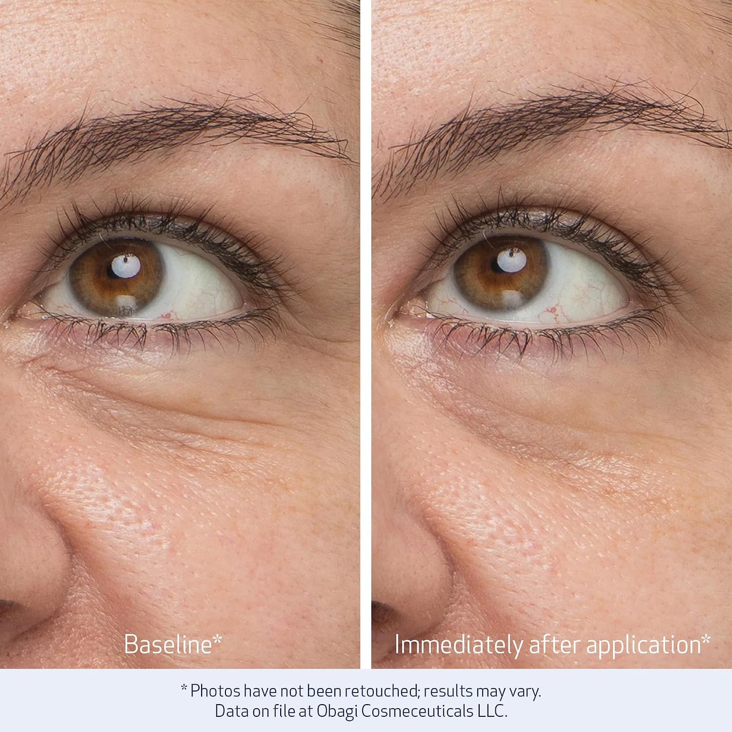Obagi Medical Eyebrow Serum & Eye Cream Duo with Nu-Cil Eyebrow Serum & Daily Hydro Drops Eye Gel Cream – Boost Brow Growth & Reduce the Appearance of Dark Circles & Puffiness
