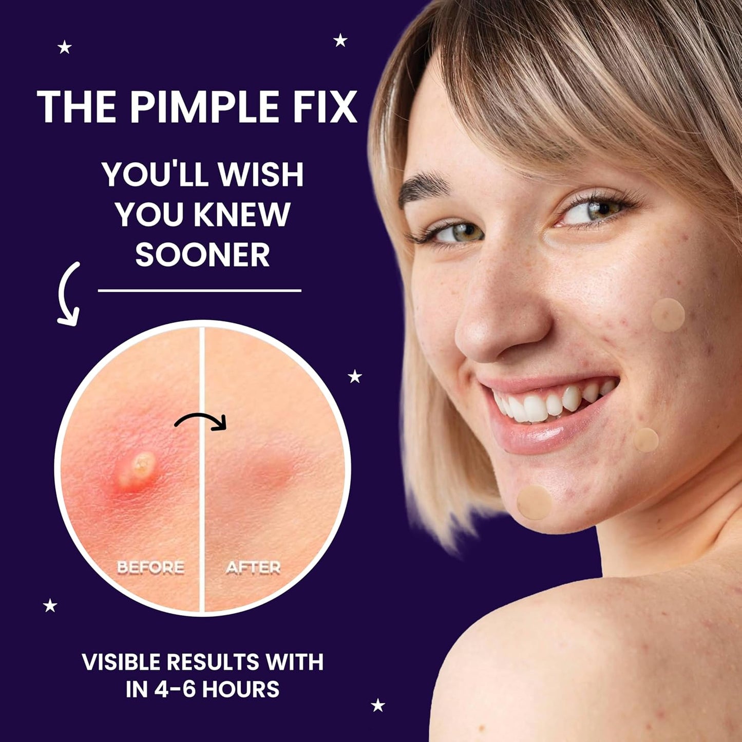 LYIO MAGICAL PATCH – 36 Ultra-Thin Blemish Dots | Breathable Hydrocolloid Patches, Gentle on All Skin Types for Clearer-Looking Skin, Invisible Under Makeup