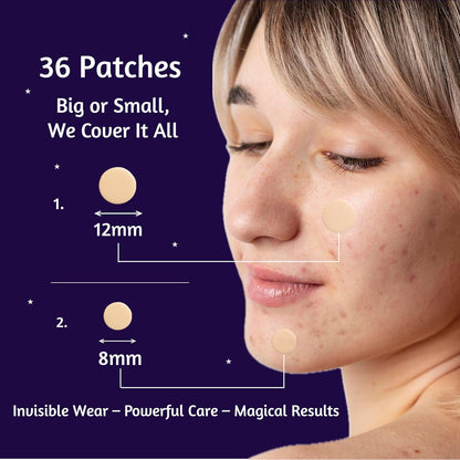 LYIO MAGICAL PATCH – 36 Ultra-Thin Blemish Dots | Breathable Hydrocolloid Patches, Gentle on All Skin Types for Clearer-Looking Skin, Invisible Under Makeup