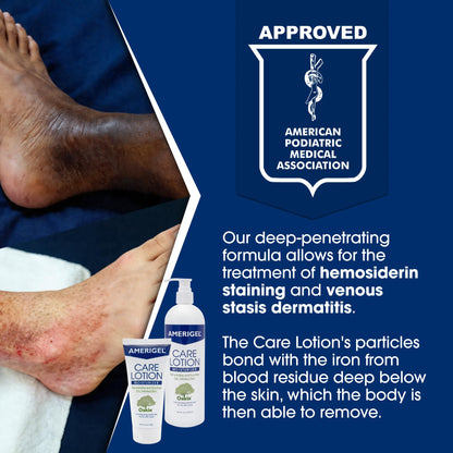 AMERIGEL Care Lotion – Hypoallergenic Moisturizer - Diabetic Skin Care - Rehydrates and Soothes Dry, Irritated Skin - 16 oz.
