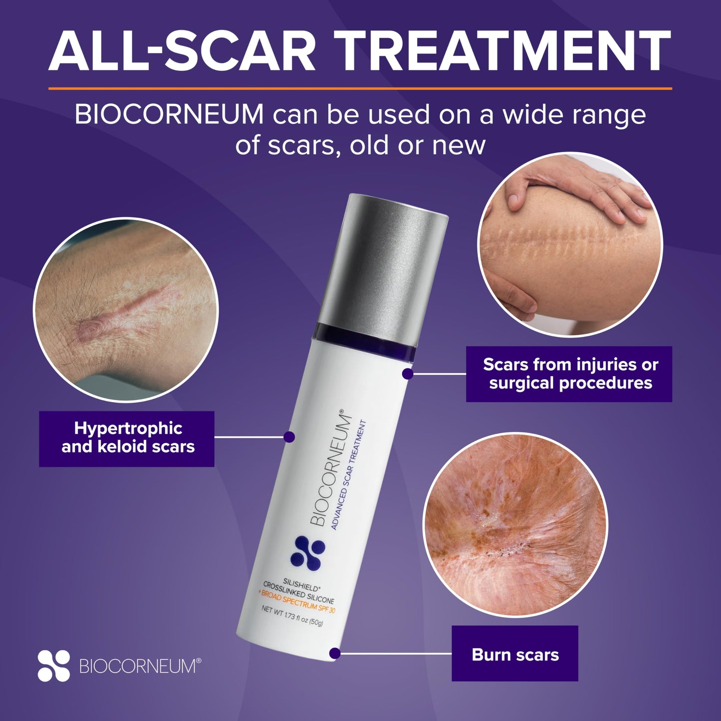 Advanced Scar Gel with Silishield® & SPF 30 50g – Silicone-Based, Water-Resistant, Fast-Drying Scar Cream for Surgical Scars, Burns & Injury – Made in USA, Safe for Kids 6+ – Surgeon Recommended