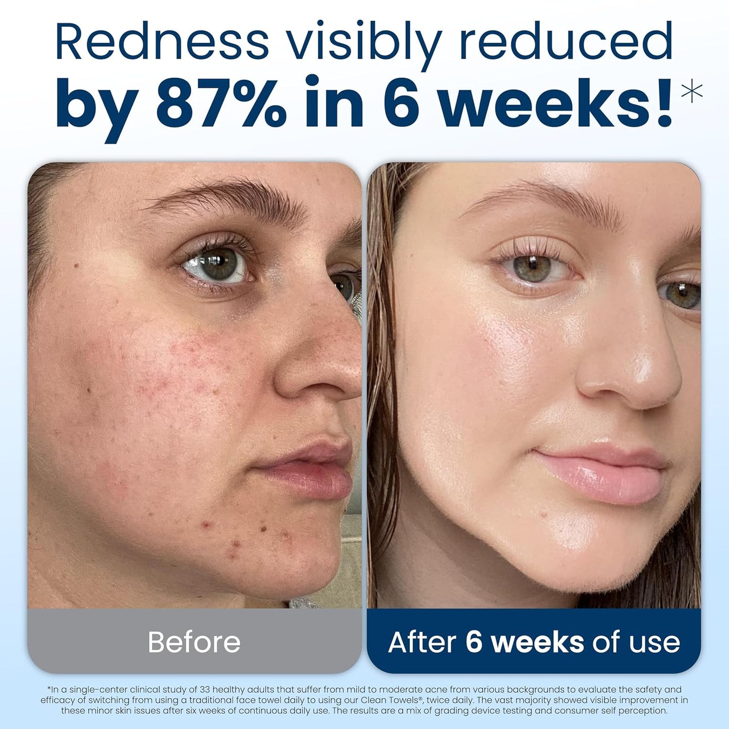 Clean Skin Club Clean Towels XL: The Game-Changer for Sensitive Skin