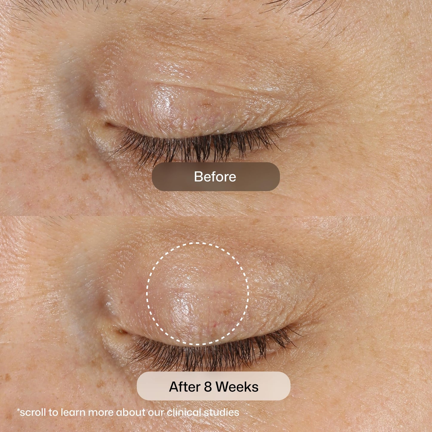 Revision Skincare D·E·J Eye Cream®, Firming and Moisturizing Treatment for Fine Lines, Wrinkles and Crow’s Feet