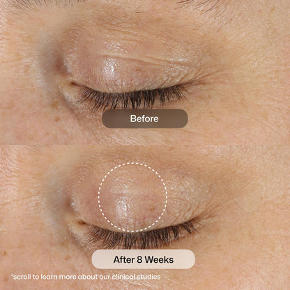 Revision Skincare D·E·J Eye Cream®, Firming and Moisturizing Treatment for Fine Lines, Wrinkles and Crow’s Feet