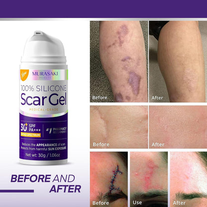 Silicone Scar Gel Scar Cream: SPF 30 Advanced Medical-Grade Formula for Surgical Scars, C-Section, Stretch Marks, Acne, Burns, Keloids, Old & New Scars – Broad Spectrum UV Protection 1.06oz (30g)