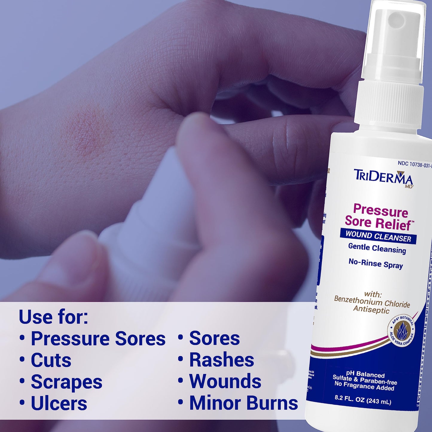 TriDerma MD Pressure Sore Relief Healing Cream for Bed Sores, Pressure Sores, Wound Healing, Chafed Skin and Hard-to-Heal Skin Sores with Calendula and AP4 Aloe Vera Gel, 4 oz Tube