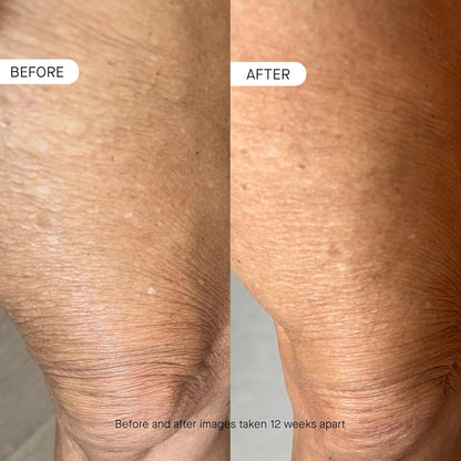 OneSkin BODY OS-01 Peptide Topical Supplement & Skin Longevity Age Reversal Moisturizer | Safe for Sensitive Skin, Fragrance-Free, 250 mL / 8.45 oz
