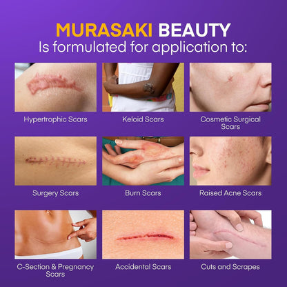 Silicone Scar Gel Scar Cream: SPF 30 Advanced Medical-Grade Formula for Surgical Scars, C-Section, Stretch Marks, Acne, Burns, Keloids, Old & New Scars – Broad Spectrum UV Protection 1.06oz (30g)