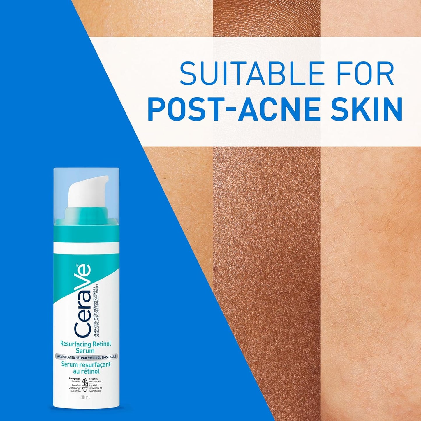 CeraVe Resurfacing Retinol Serum für das Gesicht mit Niacinamid. Hilft, den Hautton auszugleichen und die Haut zu glätten, gegen Pickelmale und zur Porenverkleinerung. Sanft, parfümfrei, nicht komedogen, sicher für empfindliche Haut, 30 ml