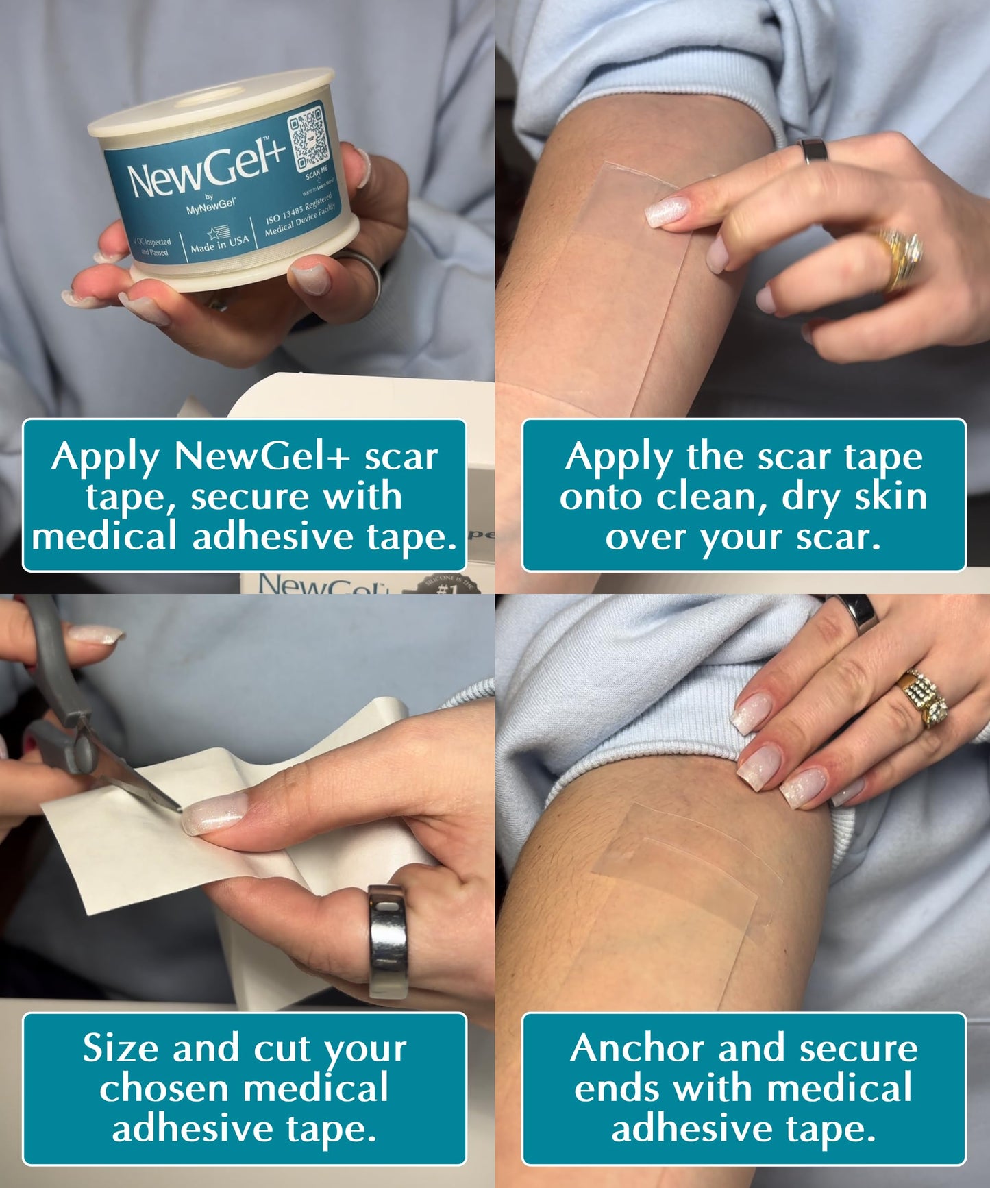 NewGel Plus Silicone Scar Tape Roll by MyNewGel – 100% Medical-Grade Silicone Scar Sheet for Surgery, C-Section, Keloid & Acne Scars – Extra Thick 1mm Tape – Made in USA – 1.5” x 96”