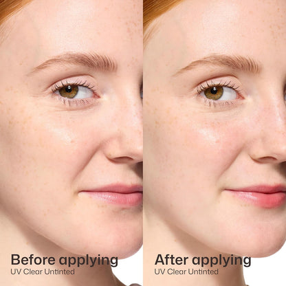 EltaMD UV Clear Face Sunscreen: A Game-Changer for Sensitive Skin