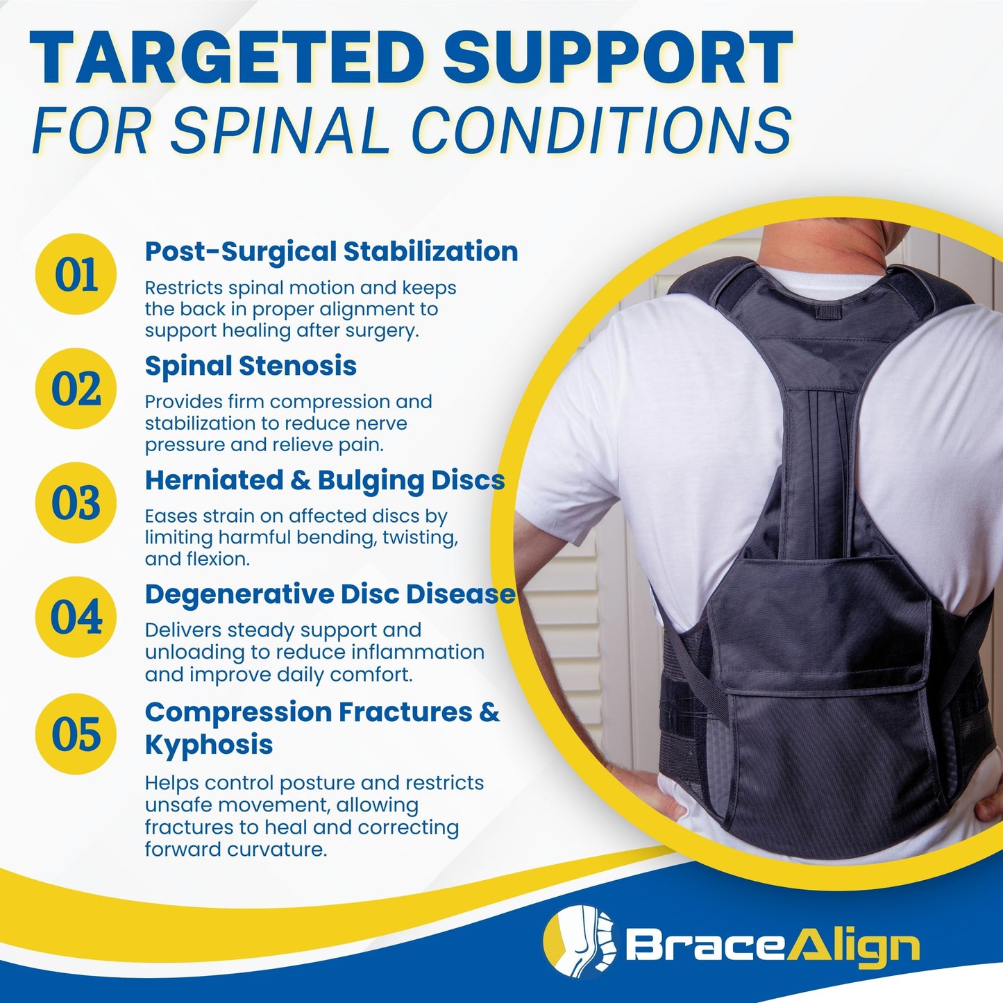 ComfortCore TLSO Back Brace - Thoracic Lumbar Spine Support for Kyphosis, Herniated Disc, Spinal Stenosis & Back Pain - Adjustable Posture Correction - L0456 L0457 (OSFM - UNIVERSAL)
